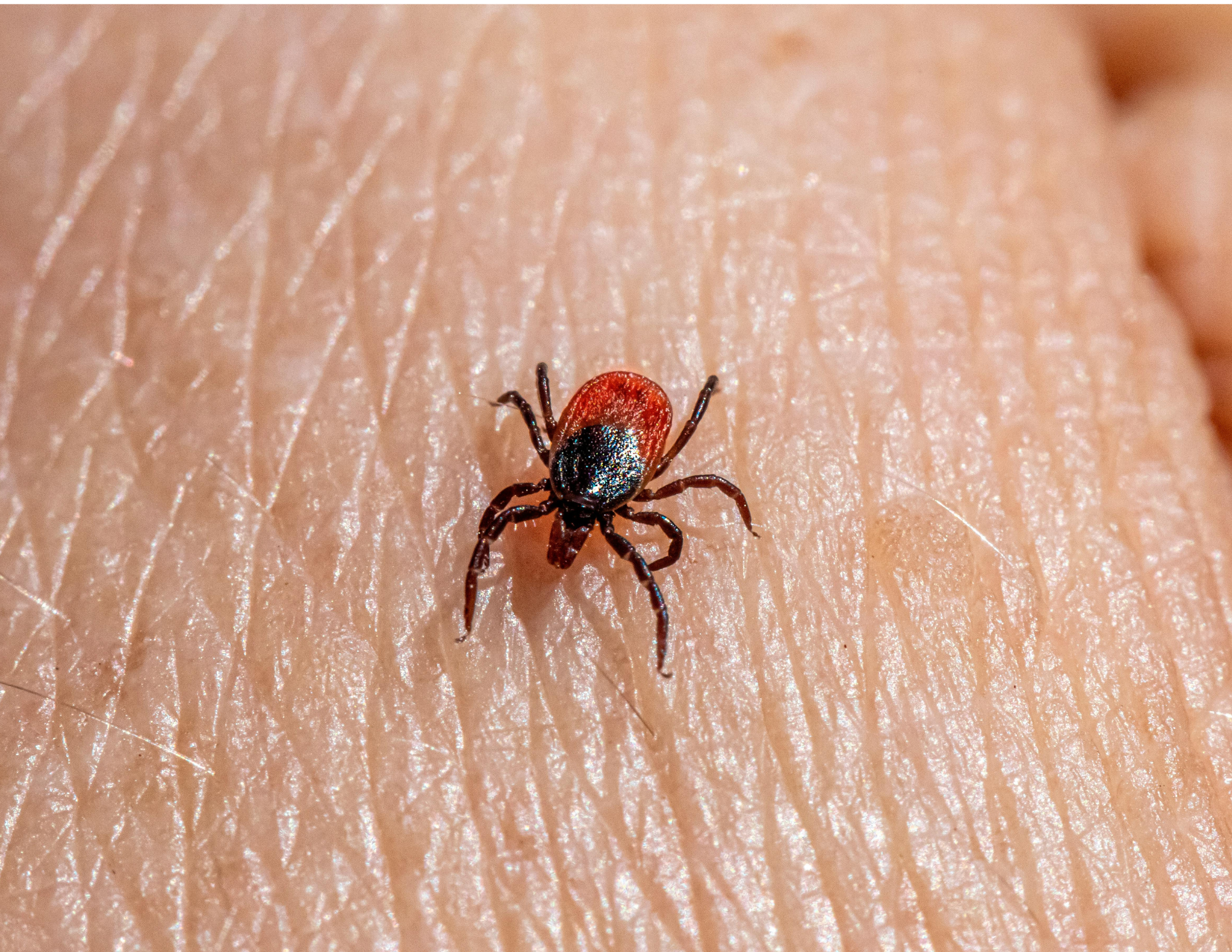 Tick Bite Prevention and Treatment Tips from Immediate Care 