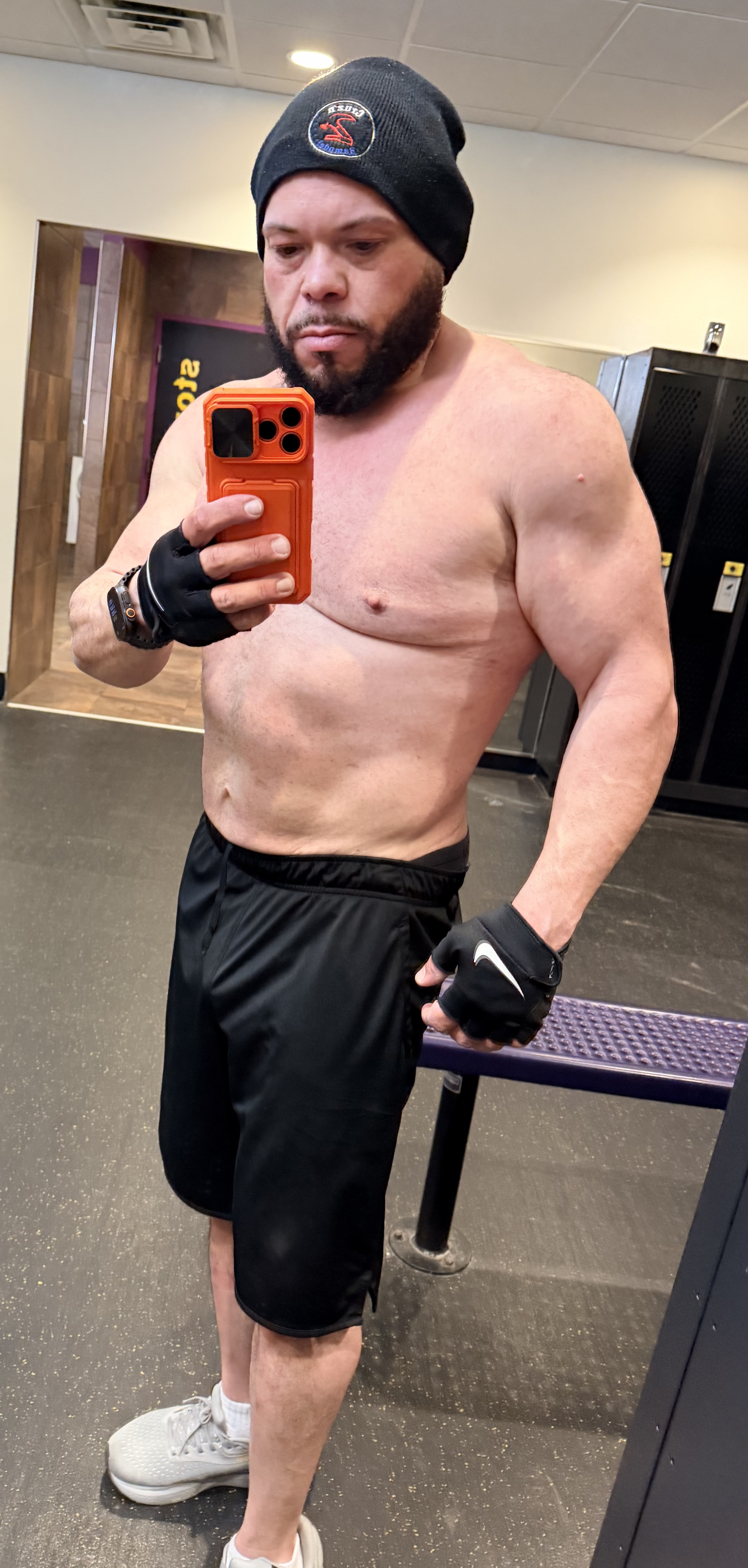 Carlos Weight Loss Update Southern NH Weight Management