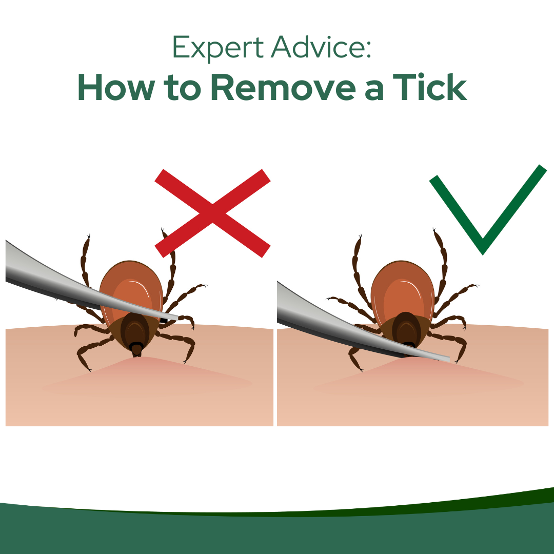 tick removal tips from Immediate Care