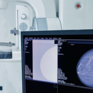 Busting the Top 5 Breast Cancer Myths 